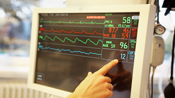 EKG Practice Strips Navigator: Your Route to Mastery